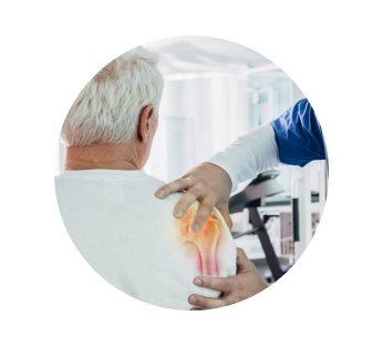 КТ плечевого сустава