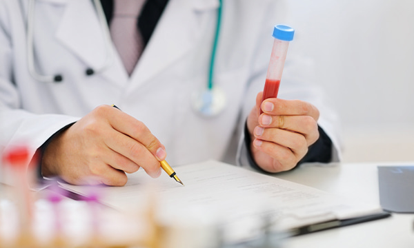 Исследование уровня антигена аденогенных раков CA 72-4 в крови