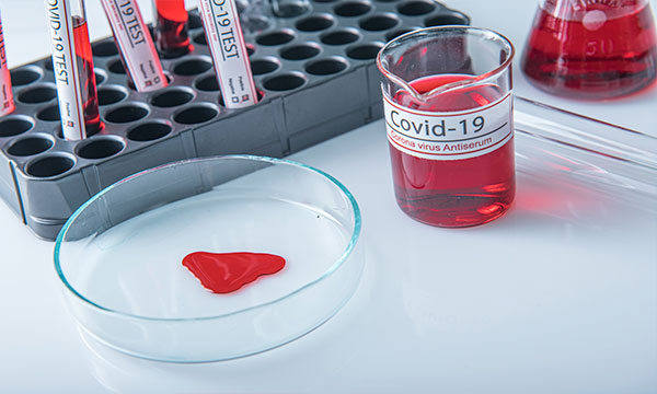 Анализ на антитела M, G (IgM, IgG) к коронавирусу (SARS-CoV-2) в крови