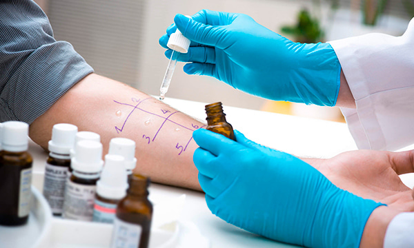 Аллергочип, ImmunoCAP ISAC, 112 компонентов