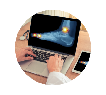 Рентген стопы