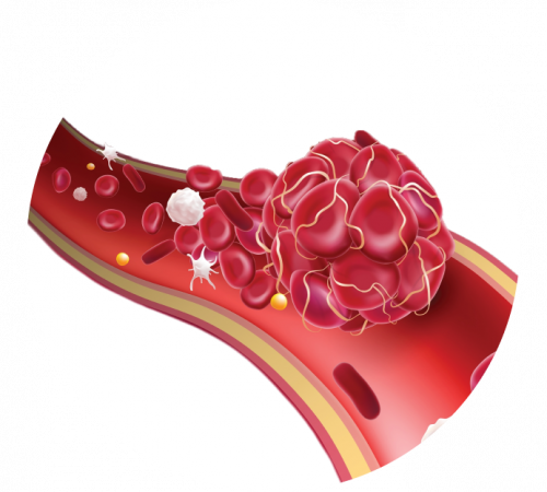 МРТ сосудов