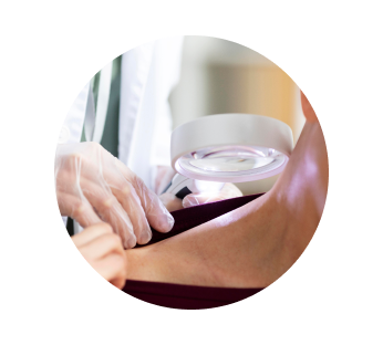 Биопсия мягких тканей