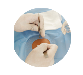 Биопсия кожи