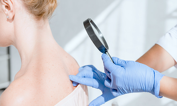 Люминесцентная диагностика (осмотр под лампой Вуда)