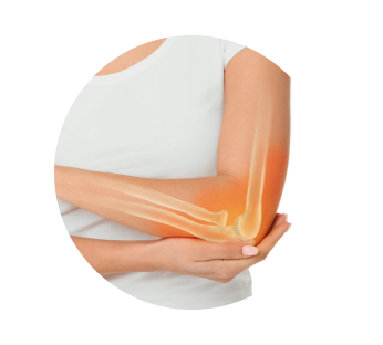 КТ локтевого сустава