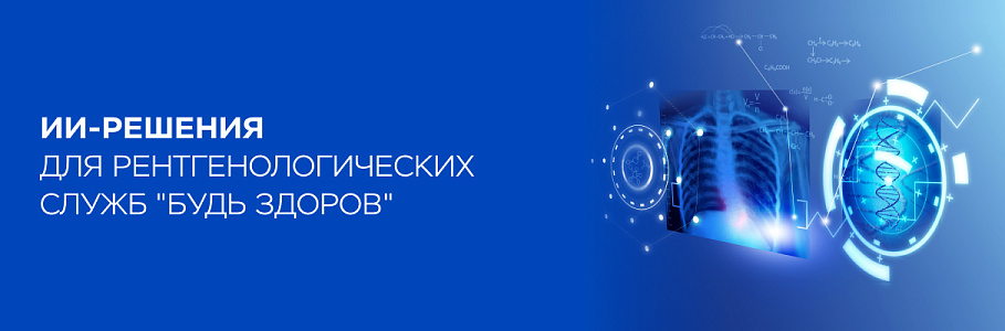 ИИ-решения «Цельс» в сети клиник “Будь Здоров” позволили сократить время рентгенологических исследований с 30 минут до двух