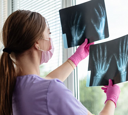 Рентгенография