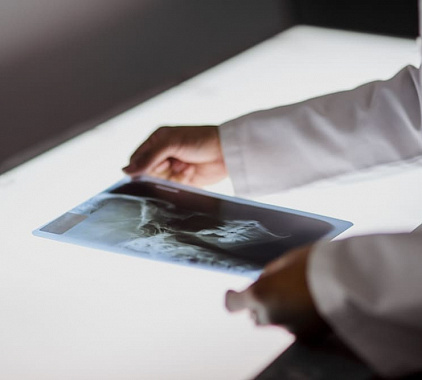 Рентгенография